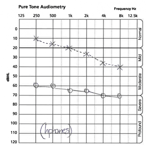 A Patient Guide To Understanding Your Audiogram Results - Attune