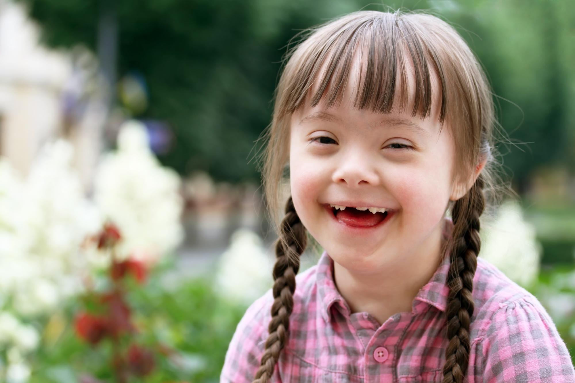 how-does-down-syndrome-affect-a-child-cognitive-development